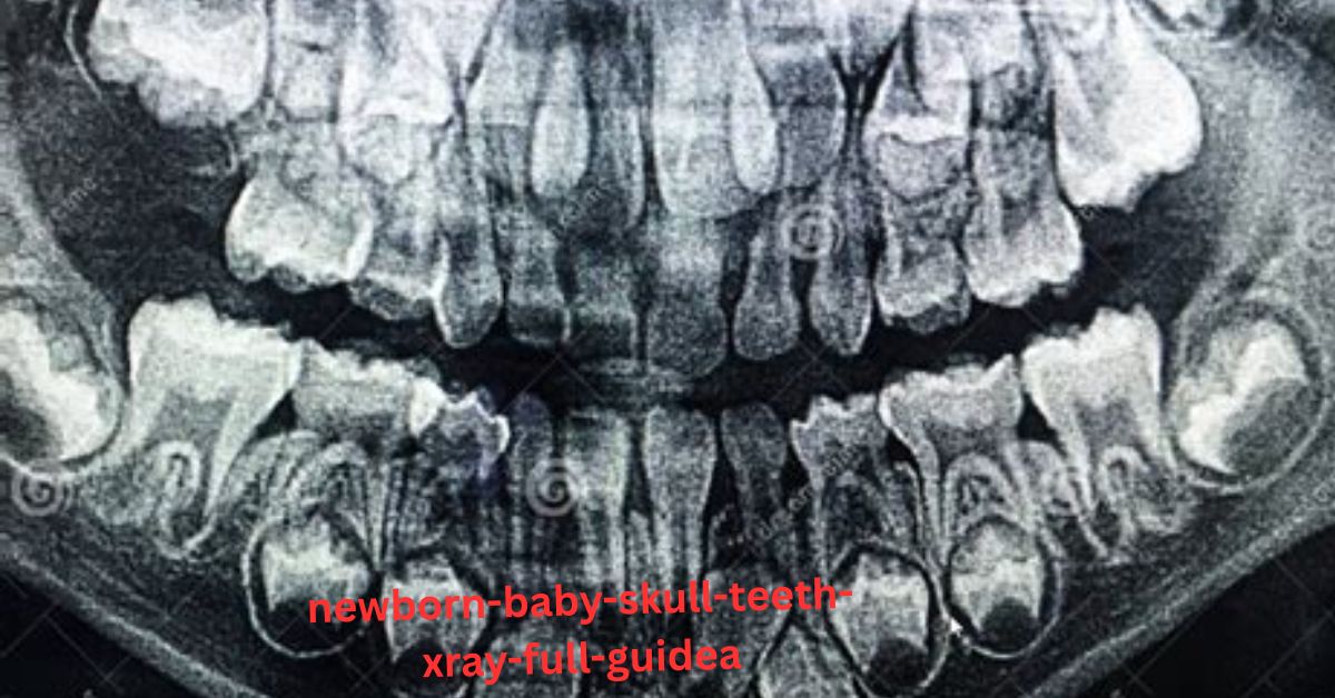 Newborn Baby Skull Teeth Xray showing developing teeth inside a newborn’s skull, revealing nature’s fascinating design.